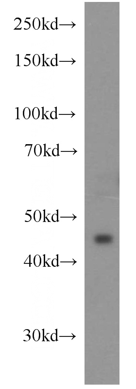 HeLa cells were subjected to SDS PAGE followed by western blot with Catalog No:112158(LAX1 antibody) at dilution of 1:1500