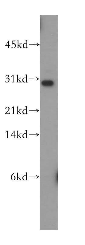 U-937 cells were subjected to SDS PAGE followed by western blot with Catalog No:116353(TRBV5-4 antibody) at dilution of 1:400