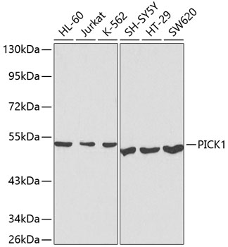 Western blot - PICK1 Polyclonal Antibody 