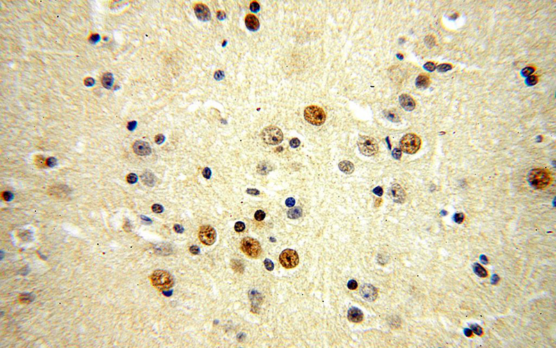 Immunohistochemical of paraffin-embedded human brain using Catalog No:116954(ZNF18 antibody) at dilution of 1:50 (under 40x lens)