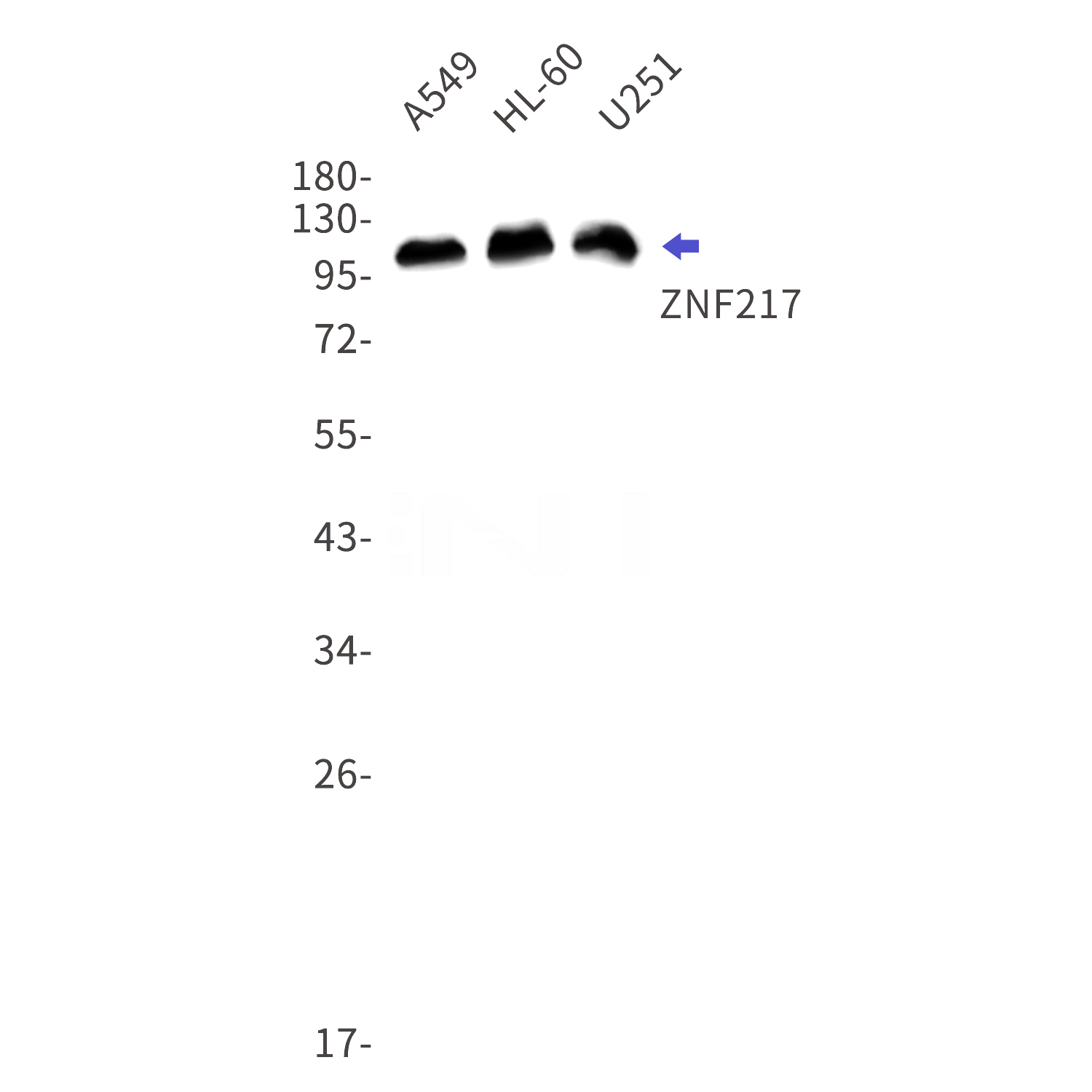 Western blot detection of ZNF217 in A549,HL-60,U251 cell lysates using ZNF217 Rabbit mAb(1:1000 diluted).Predicted band size:115kDa.Observed band size:115kDa.