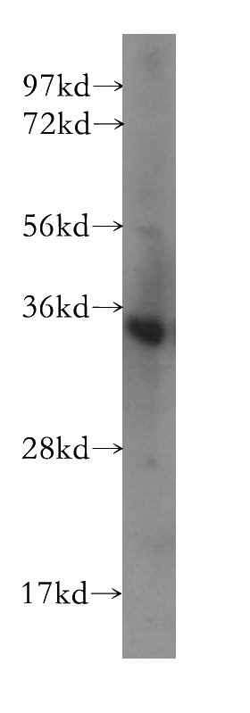 human brain tissue were subjected to SDS PAGE followed by western blot with Catalog No:109556(CRH antibody) at dilution of 1:400