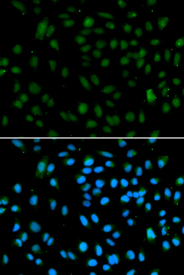 Immunofluorescence - WHSC1L1 Polyclonal Antibody 