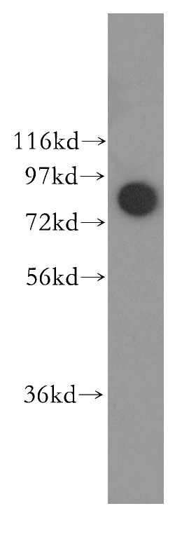 HeLa cells were subjected to SDS PAGE followed by western blot with Catalog No:109779(DDX1 antibody) at dilution of 1:500