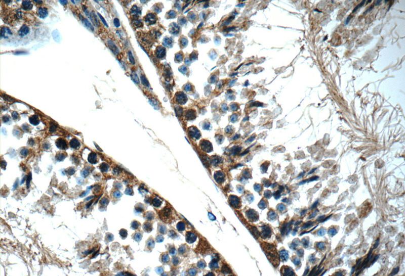 Immunohistochemistry of paraffin-embedded mouse testis tissue slide using Catalog No:115961(TEX264 Antibody) at dilution of 1:50 (under 40x lens)