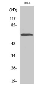 Fig1:; Western Blot analysis of various cells using NEIL3 Polyclonal Antibody diluted at 1: 2000 cells nucleus extracted by Minute TM Cytoplasmic and Nuclear Fractionation kit (SC-003,Inventbiotech,MN,USA).