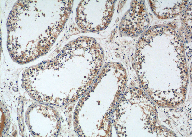Immunohistochemistry of paraffin-embedded human testis tissue slide using Catalog No:116120(TICAM2 Antibody) at dilution of 1:50 (under 10x lens)