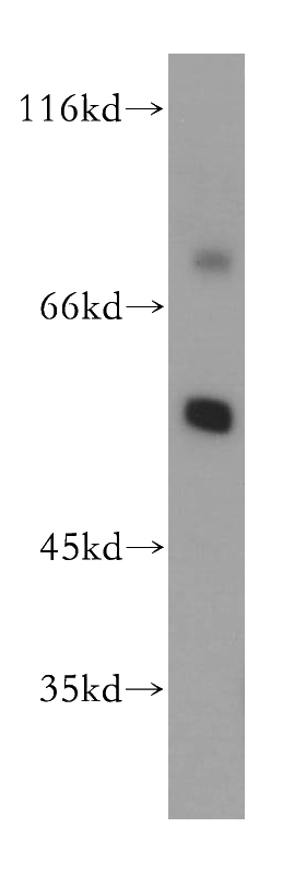 SH-SY5Y cells were subjected to SDS PAGE followed by western blot with Catalog No:112539(MGAT4C antibody) at dilution of 1:300