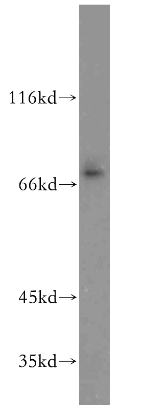 A375 cells were subjected to SDS PAGE followed by western blot with Catalog No:110160(SLC1A6 antibody) at dilution of 1:300