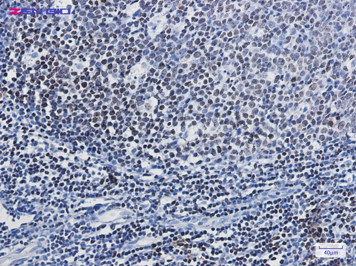 Immunohistochemistry of PARP1 in paraffin-embedded Human tonsil using PARP1 Rabbit pAb at dilution 1/50