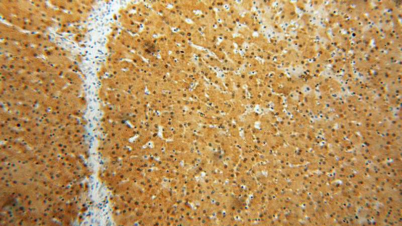 Immunohistochemical of paraffin-embedded human liver using Catalog No:110913(GCOM1 antibody) at dilution of 1:100 (under 10x lens)