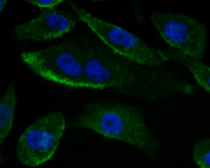 Fig2: ICC staining Gp83 in PC-3M cells (green). The nuclear counter stain is DAPI (blue). Cells were fixed in paraformaldehyde, permeabilised with 0.25% Triton X100/PBS.