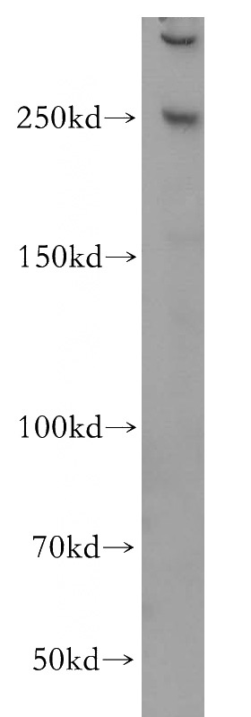 HeLa cells were subjected to SDS PAGE followed by western blot with Catalog No:109270(CEP250,C-NAP1 antibody) at dilution of 1:500