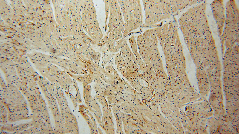 Immunohistochemical of paraffin-embedded human heart using Catalog No:116054(THBD antibody) at dilution of 1:50 (under 10x lens)
