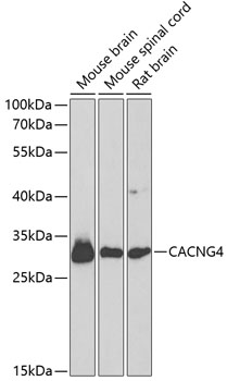 Western blot - CACNG4 Polyclonal Antibody 