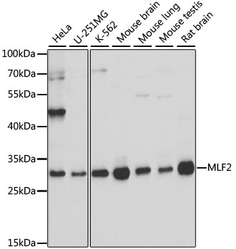 Western blot - MLF2 Polyclonal Antibody 