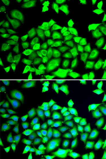 Immunofluorescence - CLCN7 Polyclonal Antibody 