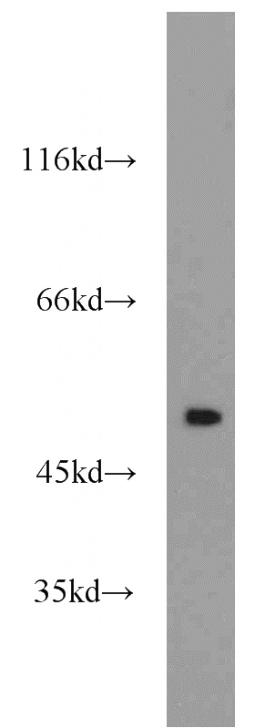 HeLa cells were subjected to SDS PAGE followed by western blot with Catalog No:114107(PPP2R5E antibody) at dilution of 1:1000