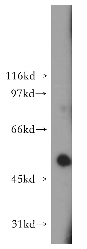A375 cells were subjected to SDS PAGE followed by western blot with Catalog No:110833(GALC antibody) at dilution of 1:3000
