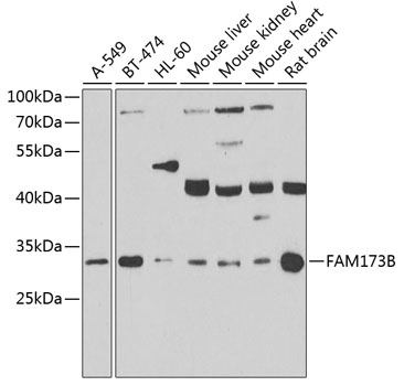 Western blot - FAM173B Polyclonal Antibody 