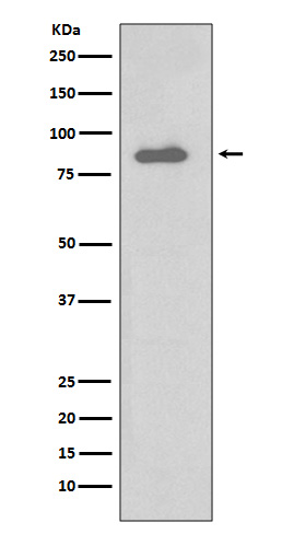 Western blot analysis of IKK alpha expression in Daudi cell lysate.