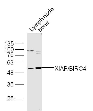 Fig3: Sample:; Lymph node(Mouse) Lysate at 40 ug; Bone(Mouse) Lysate at 40 ug; Primary: Anti-XIAP/BIRC4 at 1/300 dilution; Secondary: IRDye800CW Goat Anti-Rabbit IgG at 1/20000 dilution; Predicted band size: 55 kD; Observed band size: 53 kD