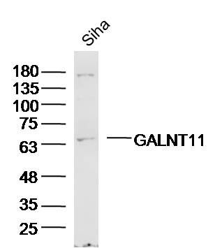 Fig2: Sample:siha(human) Cell Lysate at 40 ug; Primary: Anti-GALNT11 at 1/300 dilution; Secondary: IRDye800CW Goat Anti-Rabbit IgG at 1/20000 dilution; Predicted band size: 69kD; Observed band size: 69kD