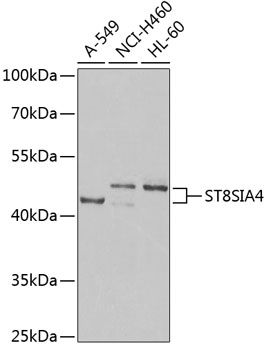 Western blot - ST8SIA4 Polyclonal Antibody 