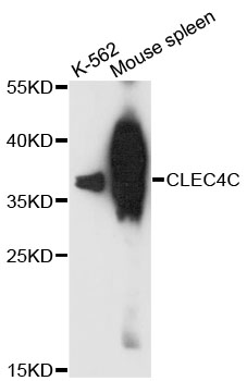 Western blot - CLEC4C Polyclonal Antibody 