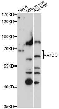 Western blot - A1BG Polyclonal Antibody 