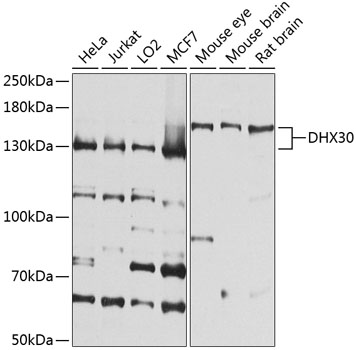 Western blot - DHX30 Polyclonal Antibody 