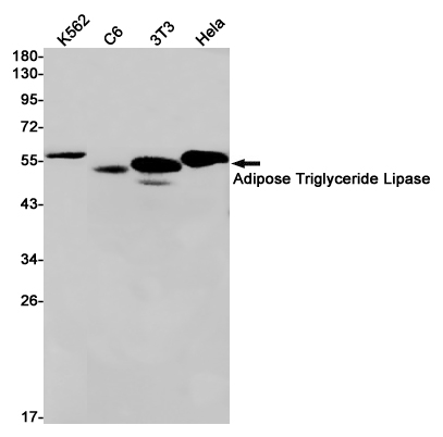 Western blot detection of Adipose Triglyceride Lipase in K562,C6,3T3,Hela cell lysates using Adipose Triglyceride Lipase Rabbit pAb(1:1000 diluted).Predicted band size:55kDa.Observed band size:55kDa.