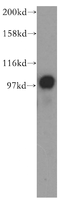 HeLa cells were subjected to SDS PAGE followed by western blot with Catalog No:116223(TPX2 antibody) at dilution of 1:500
