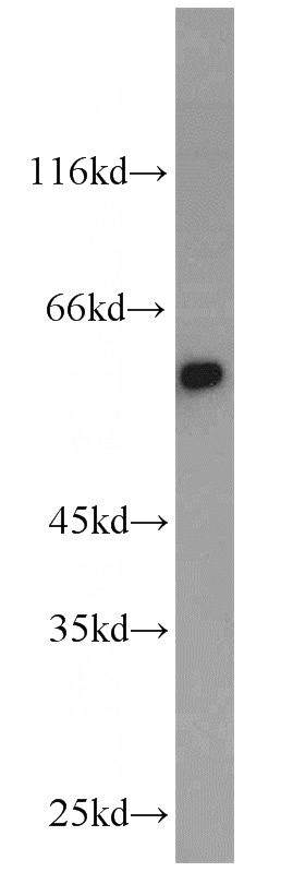 mouse heart tissue were subjected to SDS PAGE followed by western blot with Catalog No:109539(CRBN antibody) at dilution of 1:1000