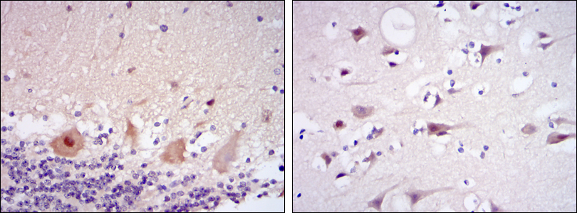 Immunohistochemical analysis of paraffin-embedded cerebellum tissues (left) and brain tissues (right) using CDK5 mouse mAb with DAB staining.