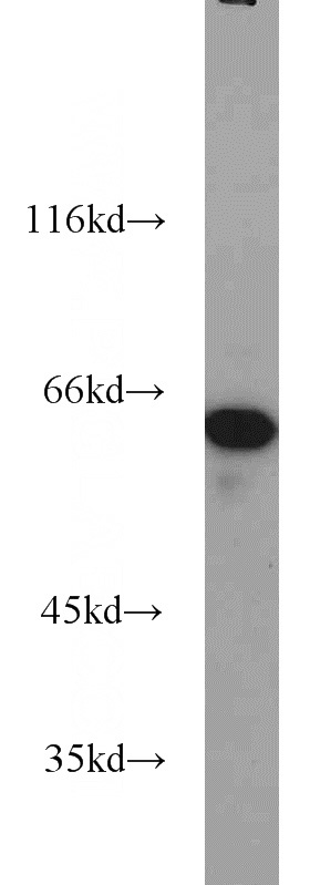 HepG2 cells were subjected to SDS PAGE followed by western blot with Catalog No:109328(CKAP4 antibody) at dilution of 1:1000