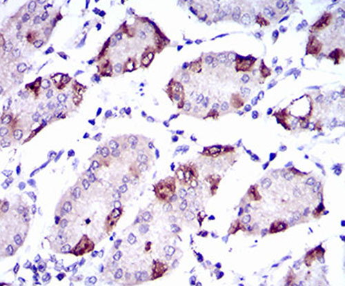 Fig5: Immunohistochemical analysis of paraffin-embedded human stomach tissue using anti-SLC27A5 antibody. Counter stained with hematoxylin.