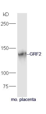 Fig2: Protein: placenta(mouse) lysate at 40ug;; Primary: rabbit Anti-GRF2 at 1:300;; Secondary: HRP conjugated Goat-Anti-rabbit IgG(bs-0295G-HRP) at 1: 5000;; Predicted band size: 140 kD; Observed band size: 140 kD