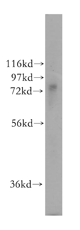 mouse liver tissue were subjected to SDS PAGE followed by western blot with Catalog No:116461(TYW1B antibody) at dilution of 1:500