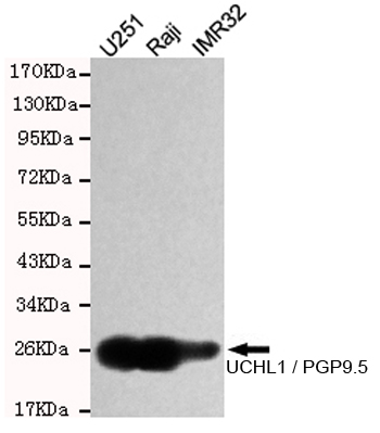 Western blot detection of UCHL1 / PGP9.5 in U251,Raji and IMR32 cell lysates and using UCHL1 / PGP9.5 mouse mAb (1:1000 diluted).Predicted band size: 25KDa.Observed band size:25KDa.