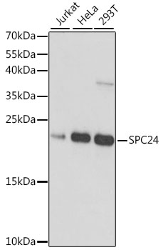 Western blot - SPC24 Polyclonal Antibody 