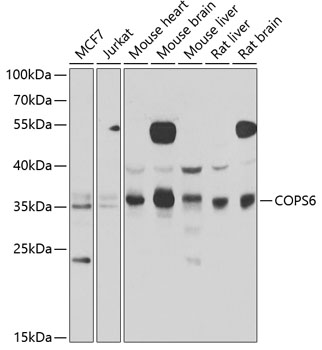 Western blot - COPS6 Polyclonal Antibody 