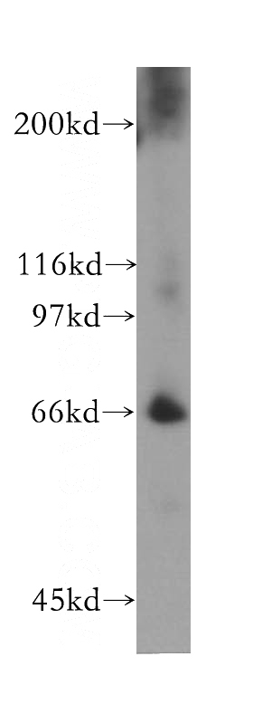 human placenta tissue were subjected to SDS PAGE followed by western blot with Catalog No:111648(IKZF2 antibody) at dilution of 1:500