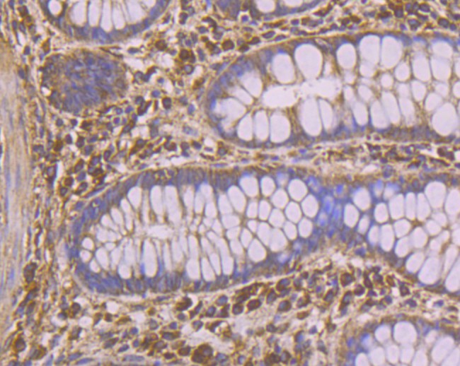 Fig7: Immunohistochemical analysis of paraffin-embedded human colon tissue using anti-PHF8 antibody. Counter stained with hematoxylin.