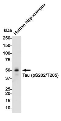 Western blot detection of Tau (Phospho-Ser202/Thr205) in Human Fetal brain cell lysates using Tau (Phospho-Ser202/Thr205) Rabbit pAb(1:1000 diluted).Predicted band size:79KDa.Observed band size:50-80KDa.