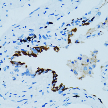 Immunohistochemistry - CTSE Polyclonal Antibody 