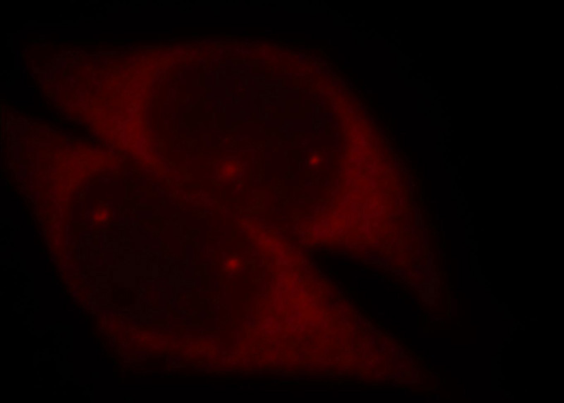Immunofluorescent analysis of Hela cells, using SMN2 antibody Catalog No:115393 at 1:25 dilution and Rhodamine-labeled goat anti-rabbit IgG (red).