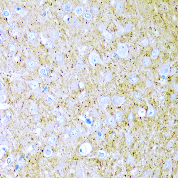 Immunohistochemistry - WNT2 Polyclonal Antibody 