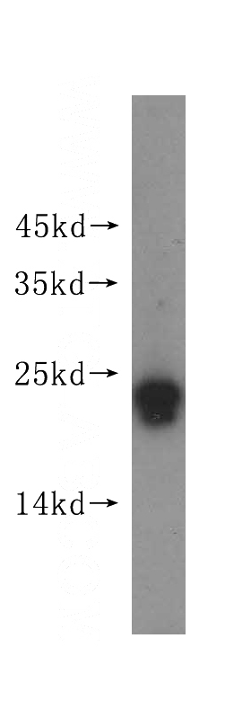 human kidney tissue were subjected to SDS PAGE followed by western blot with Catalog No:114421(RAB22A-specific antibody) at dilution of 1:300