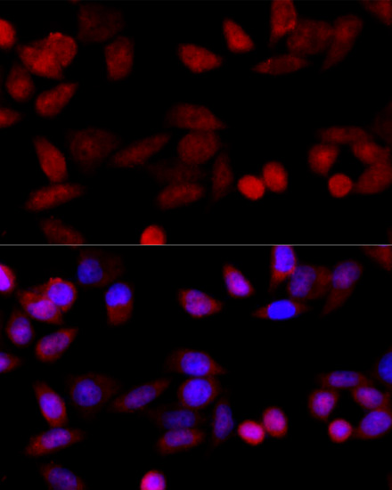 Immunofluorescence - CYP1B1 Polyclonal Antibody 